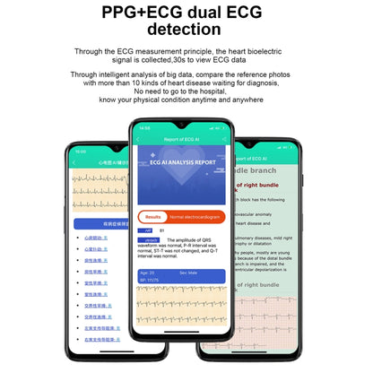 E86 1.7 inch TFT Color Screen IP68 Waterproof Smart Watch, Support Blood Oxygen Monitoring / Body Temperature Monitoring / AI Medical Diagnosis, Style: Leather Strap(Black) by bashfashion